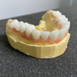 Циркониевые зубные коронки