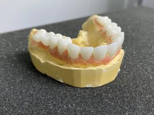 Циркониевые зубные коронки